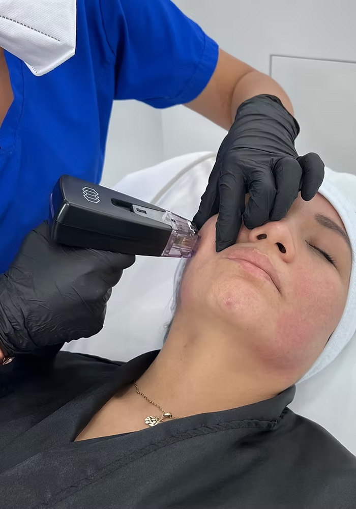 Tratamiento Facial
